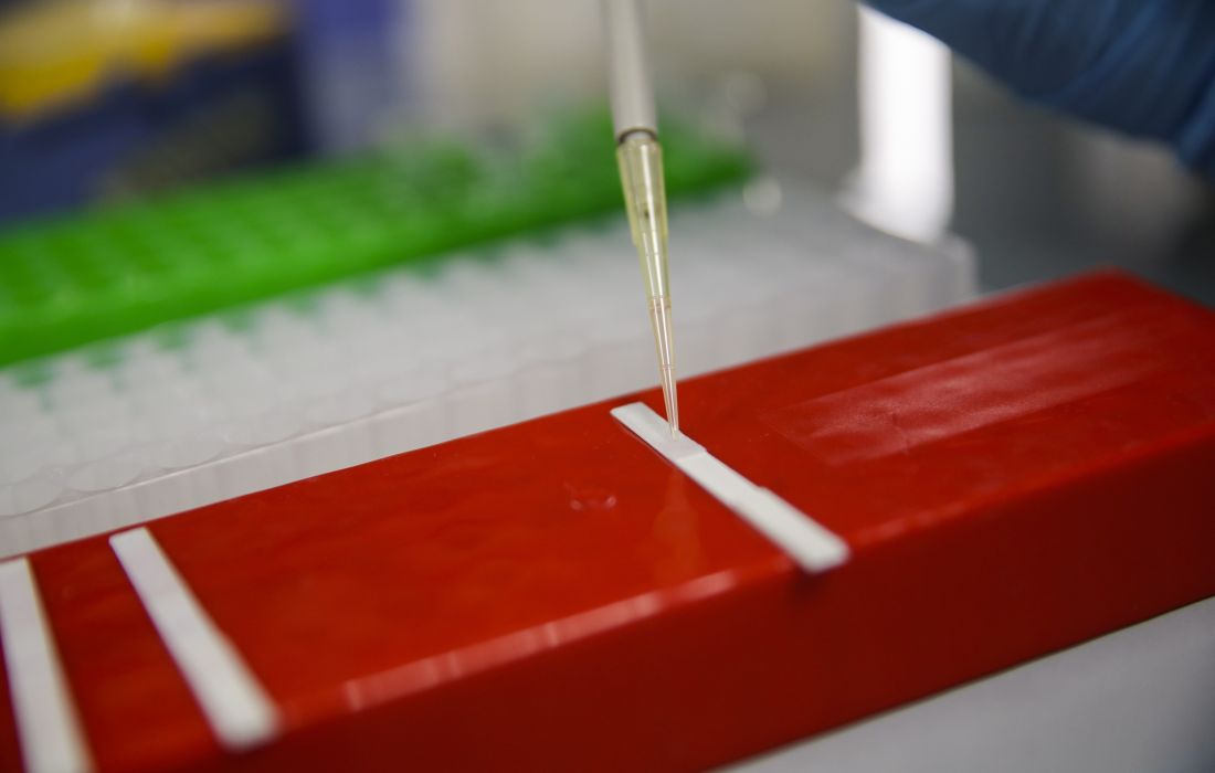 «Κλειδί» το self test για το άνοιγμα της αγοράς και των σχολείων – Τι γίνεται με την εστίαση