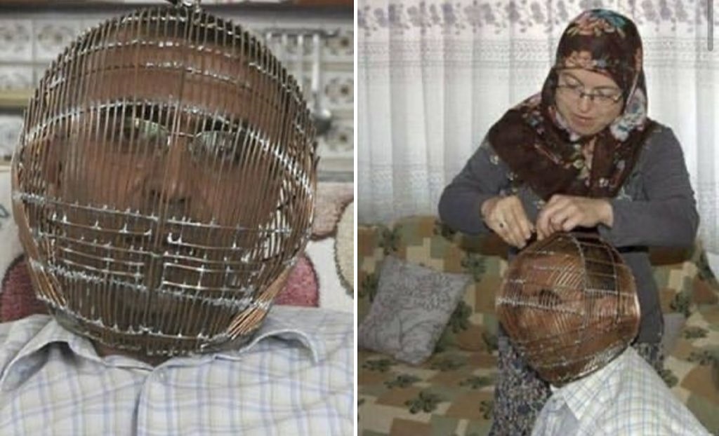 Τουρκία: Καπνιστής έβαλε το κεφάλι του σε κλουβί για να κόψει το τσιγάρο-photos