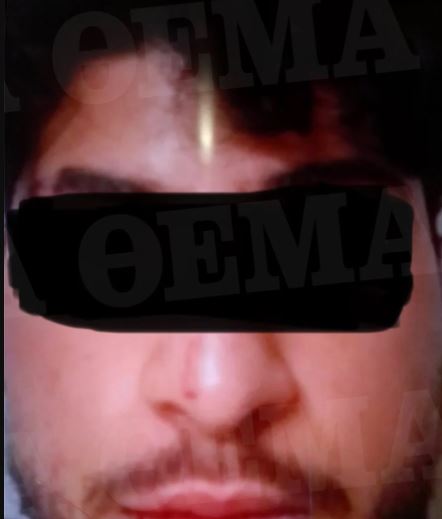 leoforeio aunanismos