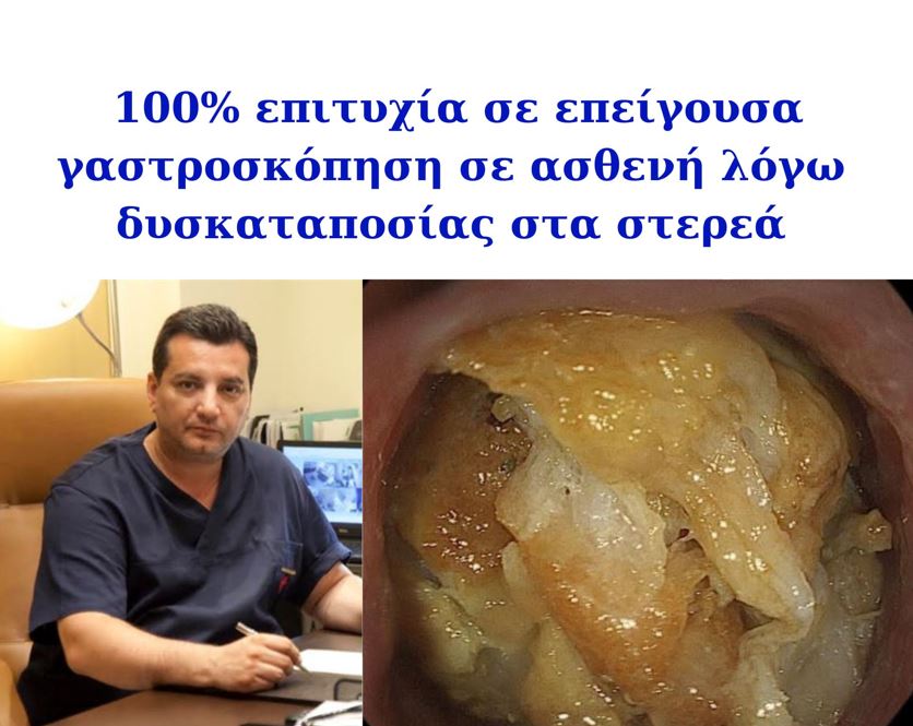 100% Επιτυχία σε γαστροσκόπηση λόγω δυσκαταποσίας στα στερεά στην Ενδοσκοπική Μονάδα Πειραιά!