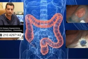 Κολονοσκόπηση και επιτυχής αφαίρεση Καρκίνου του εντέρου στην Ενδοσκοπική Μονάδα Πειραιά!!