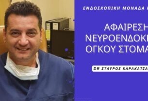 Επιτυχής Αφαίρεση όγκου στομάχου (γαστροσκόπηση) στην Ενδοσκοπική Μονάδα Πειραιά!