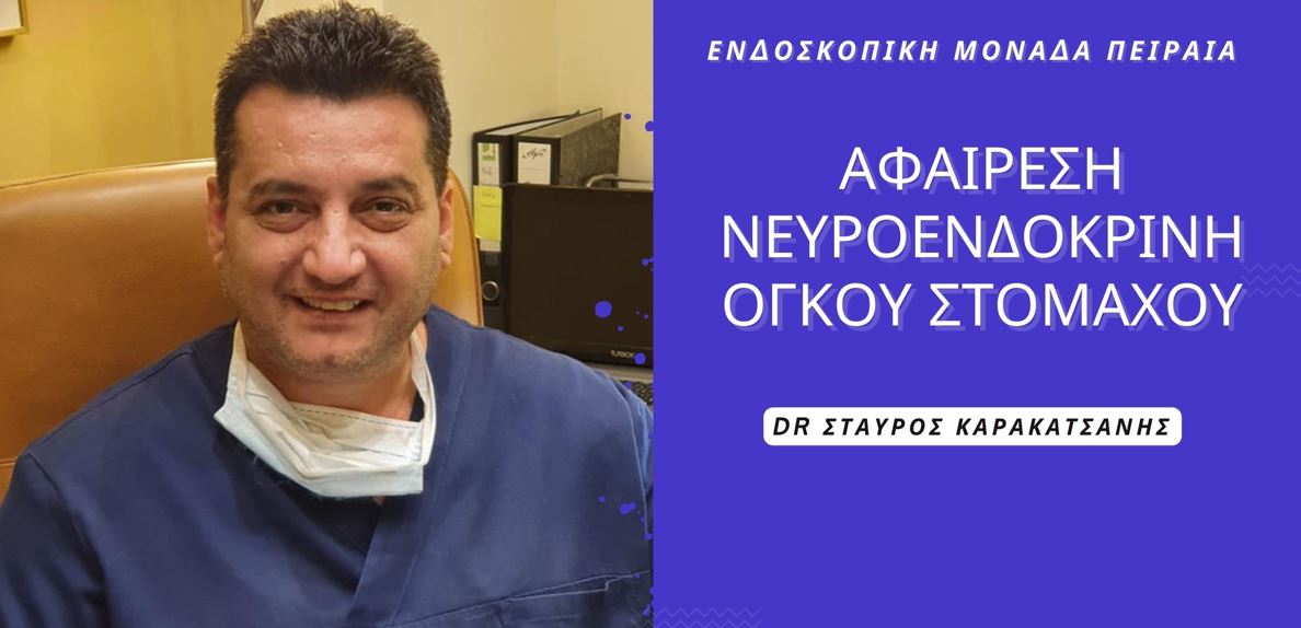 Επιτυχής Αφαίρεση όγκου στομάχου (γαστροσκόπηση) στην Ενδοσκοπική Μονάδα Πειραιά!
