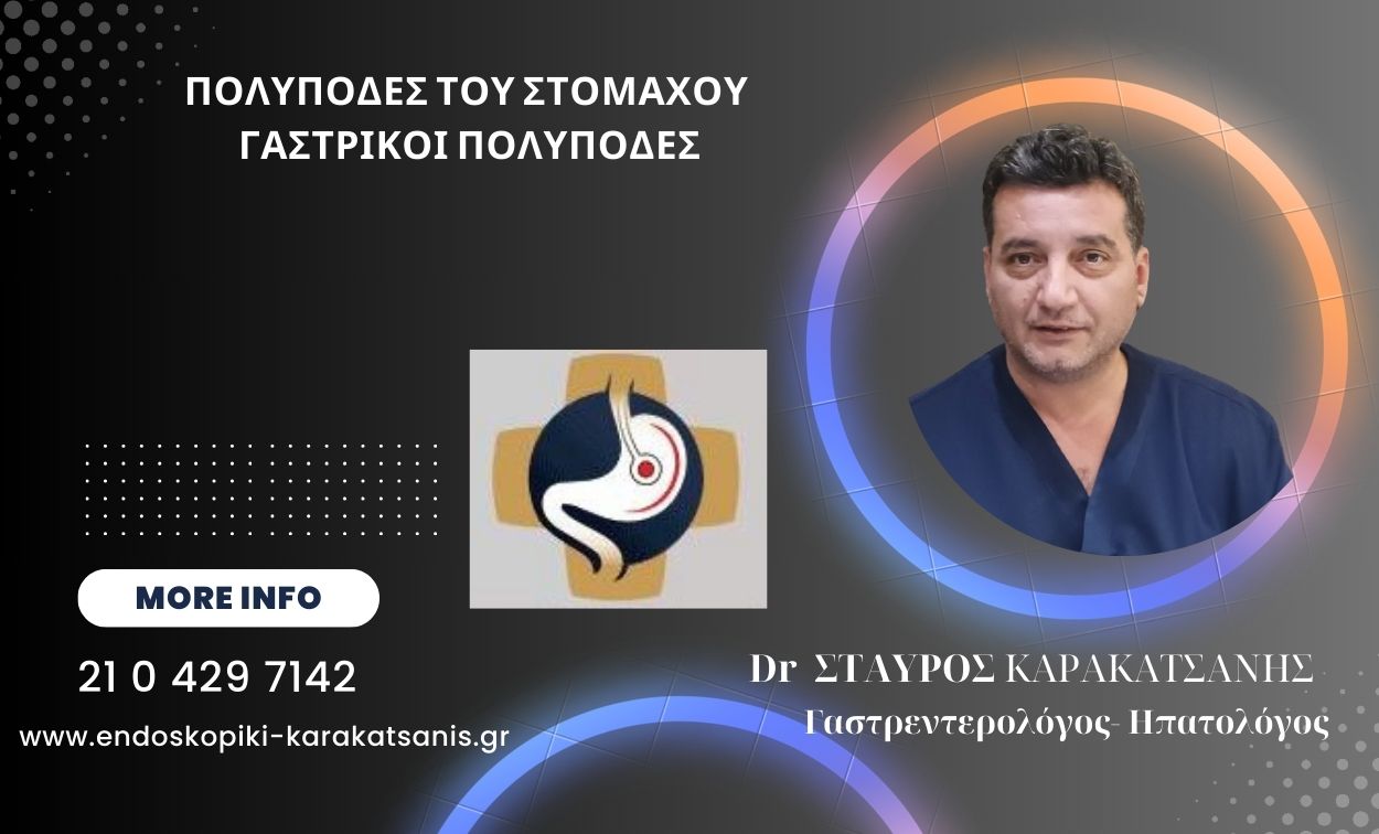 Αφαίρεση πολύποδα στομάχου στην Ενδοσκοπική μονάδα Πειραιά