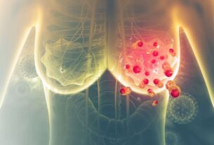 Ρωτήσαμε τη Μαστολόγο: Τι μπορεί να είναι ένας όγκος εκτός από καρκίνος του μαστού;