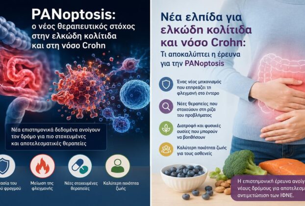 Μια νέα ελπίδα για την ελκώδη κολίτιδα και τη νόσο Crohn: Τι είναι η PANoptosis και γιατί απασχολεί την ιατρική κοινότητα