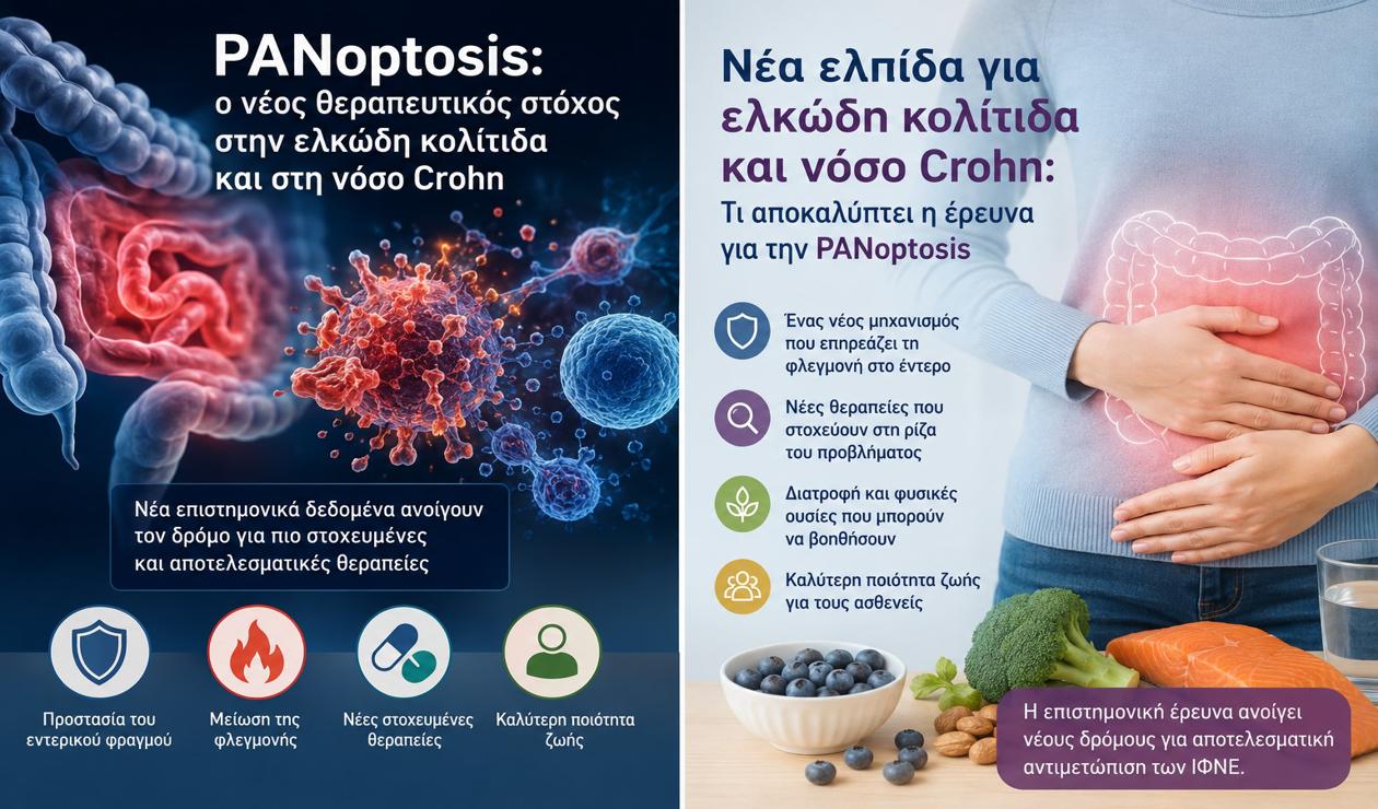 Μια νέα ελπίδα για την ελκώδη κολίτιδα και τη νόσο Crohn: Τι είναι η PANoptosis και γιατί απασχολεί την ιατρική κοινότητα